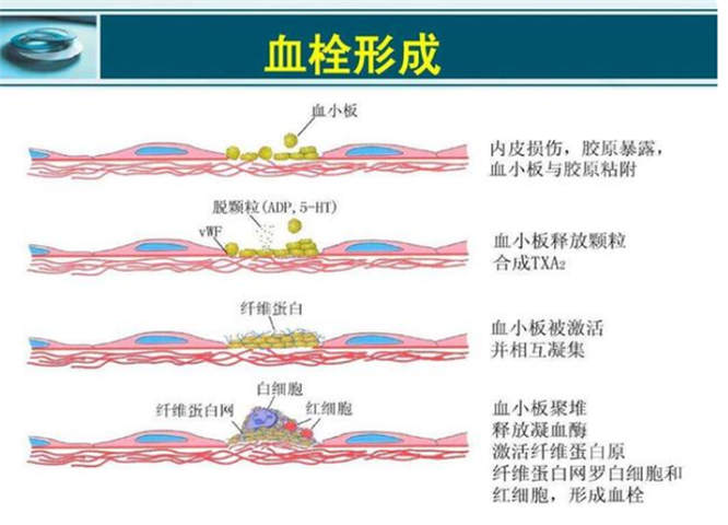 图片细节